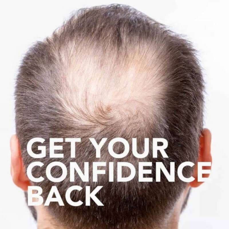 KIRKLAND Minoxidil Kirkland 5% Con Gotero 60ml - imagen 5